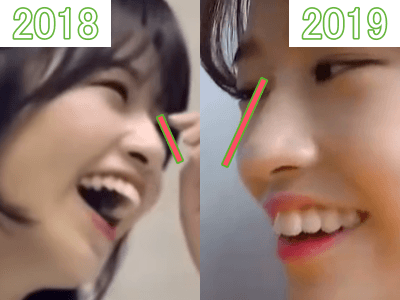 2018年（左）と2019年（右）のユジンの鼻比較