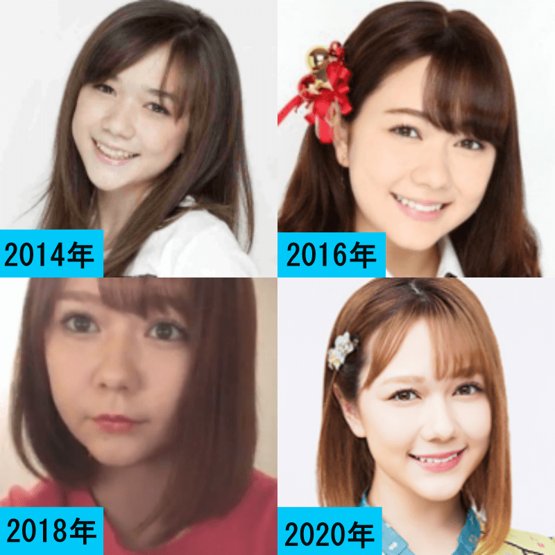 2014年から2020年までの村重杏奈さんのくちびるを比較