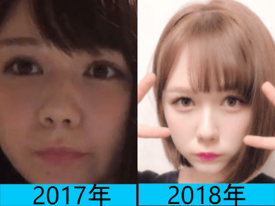 2017年（画像左）と2018年（画像右）で村重杏奈さんの顔の変化を比較している画像