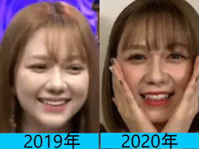 2019年（画像左）と2020年（画像右）で村重杏奈さんの顔の変化を比較している画像