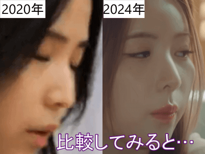 2020年（左）と2024年（右）のマヤの鼻比較