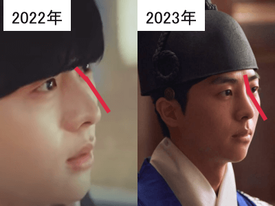 2022年（左）と2023年（右）のキム・ムジュンの鼻筋の比較