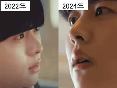 2022年（左）と2024年（右）のキム・ムジュンの鼻筋の比較