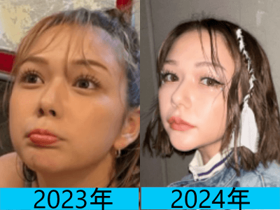 2023年（画像左）と2024年（画像右）で村重杏奈さんの顔の変化を比較している画像