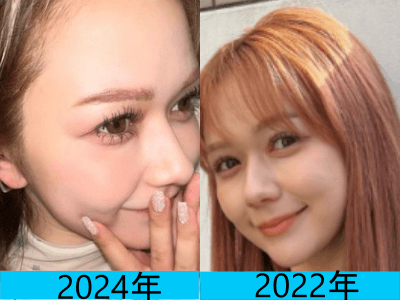 2024年（画像左）と2022年（画像右）で村重杏奈さんの鼻の頭の変化を比較している画像