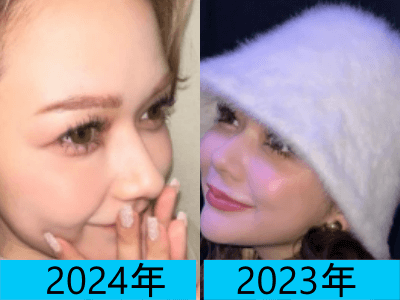 2024年（画像左）と2023年（画像右）で村重杏奈さんの鼻の頭の変化を比較している画像