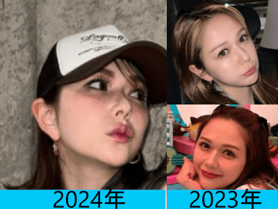 2024年（画像左）と2023年（画像右の上下）で村重杏奈さんのくちびるの変化を比較した写真