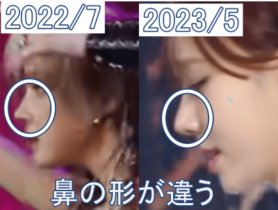 2022年7月（左）と11月（右）のウインターの鼻が違う？