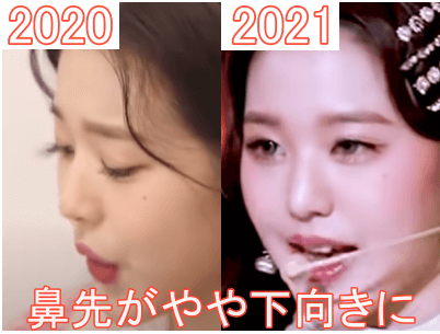 2020年（左）と2021年（右）のウォニョンの鼻比較