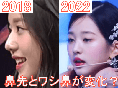 2018年（左）と2022年（右）のウォニョンの鼻比較