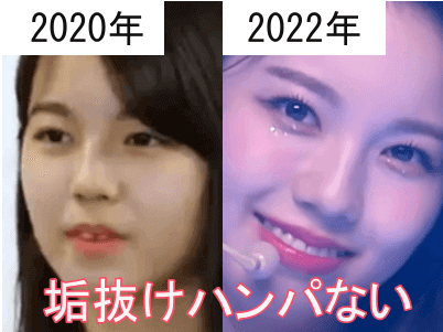 2020年（左）と2022年（右）のNiziUアヤカの顔比較画像