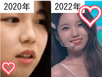 2020年（左）と2022年（右）のNiziUアヤカの正面からの顔比較