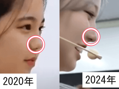 2020年（左）と2024年（右）のNiziUアヤカの鼻の頭を比較した画像