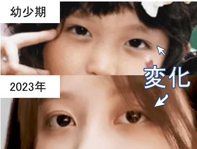 幼少期（上）と2023年（下）のガウルの目元比較