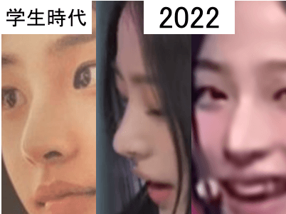 学生時代（左）と2022年（中・右）のミンジの鼻比較