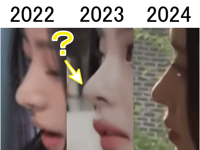 ミンジの鼻は2023年にさらに美しく？