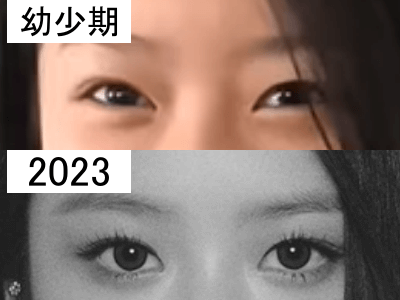 幼少期（上）と2023年（下）のハニの目を比較