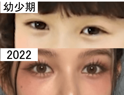 幼少期（上）と2022年（下）のダニエルの目元比較