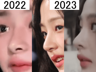 2022年（左）と2023年（中・右）のミンジの鼻比較