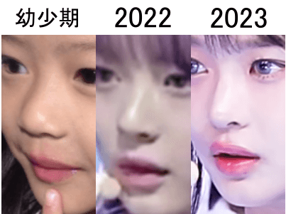 幼少期（左）、2022年（中）、2023年（右）のハニの鼻比較