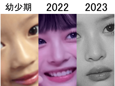 幼少期（左）、2022年（中）、2023年（右）のハニの鼻比較