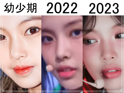 幼少期（左）、2022年（中）、2023年（右）のヘインの鼻比較