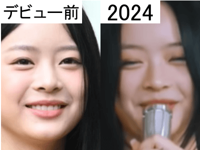 デビュー前（左）と2024年（右）のハニの鼻比較