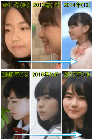 2011年から2017年の山田杏奈の鼻を比較